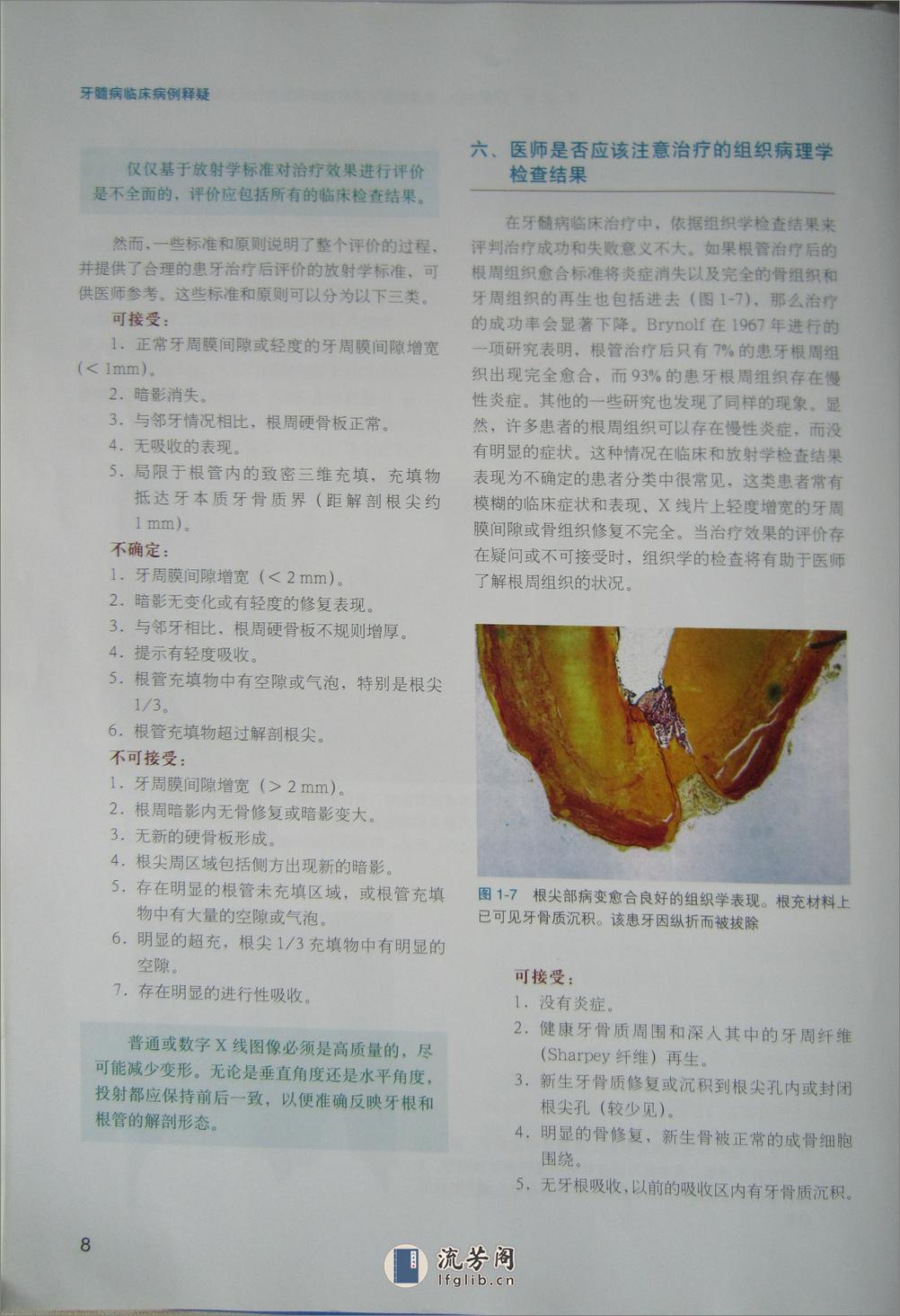 牙髓病临床病例释疑 - 第18页预览图