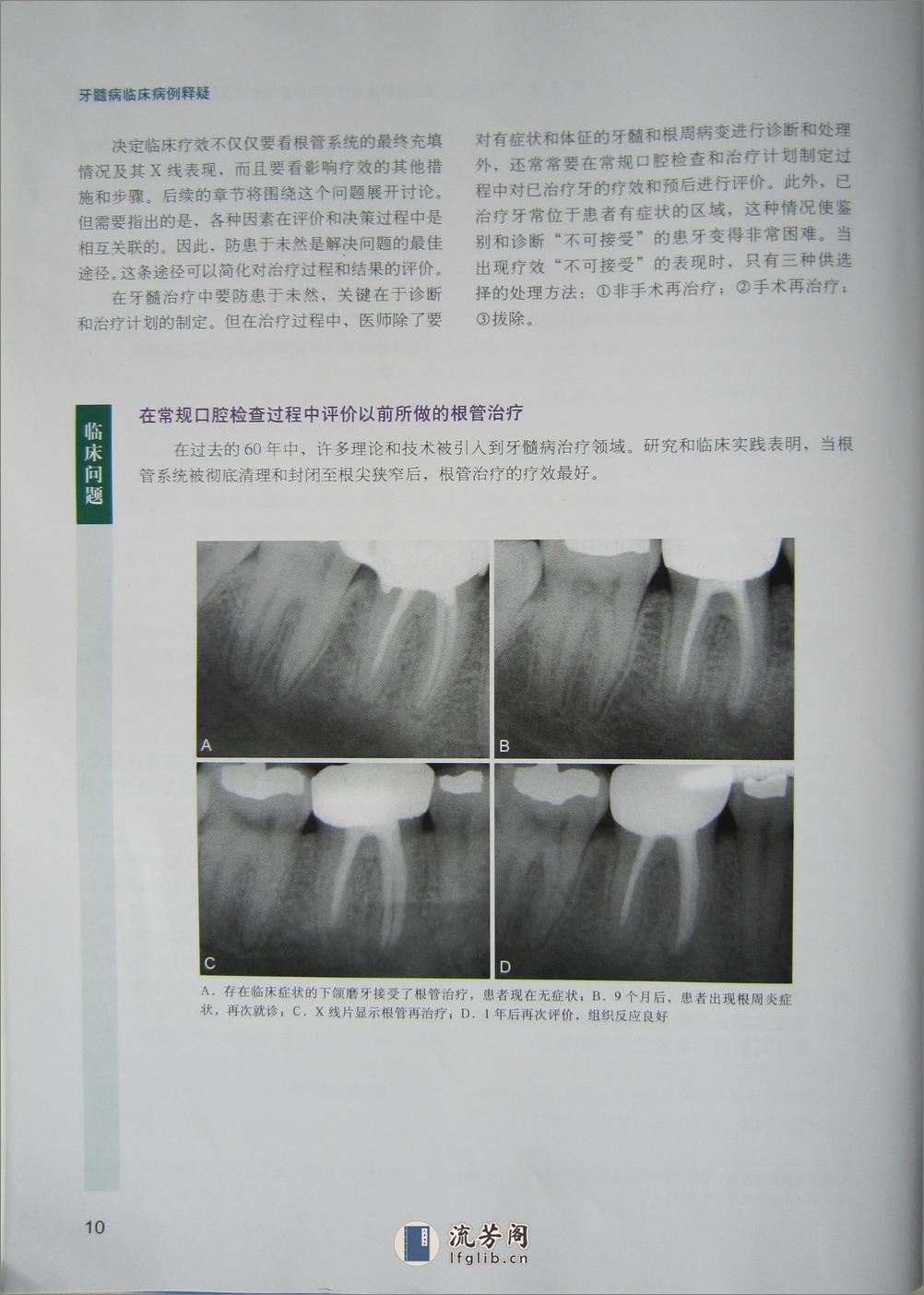 牙髓病临床病例释疑 - 第20页预览图