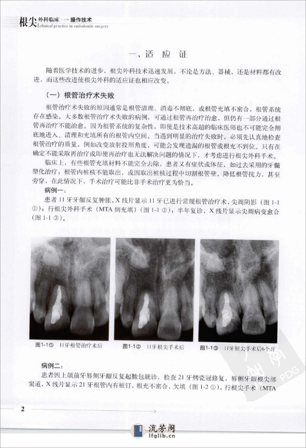 根尖外科临床操作技术_12625986 - 第10页预览图