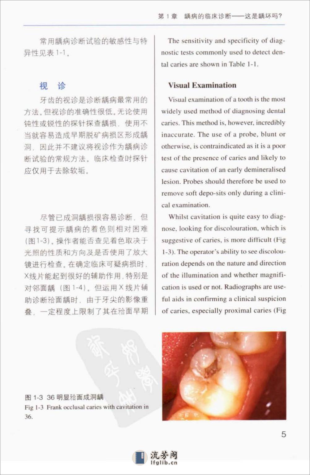 牙体修复的临床决策 - 第14页预览图