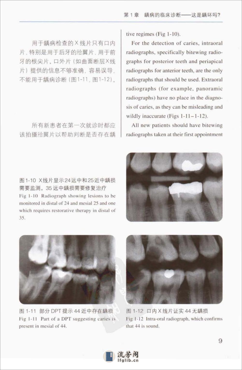 牙体修复的临床决策 - 第18页预览图