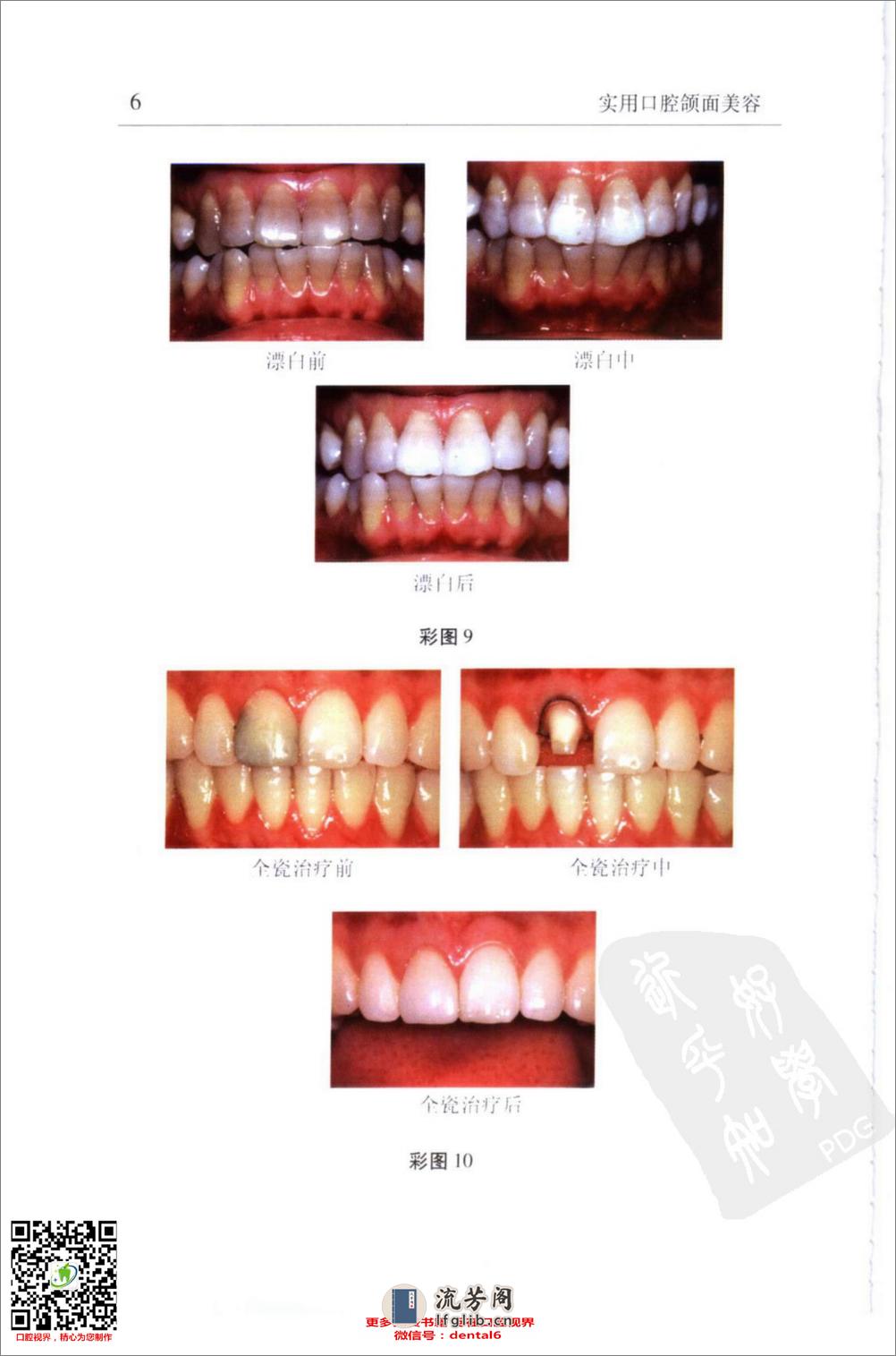 实用口腔颌面美容_11576035 - 第15页预览图