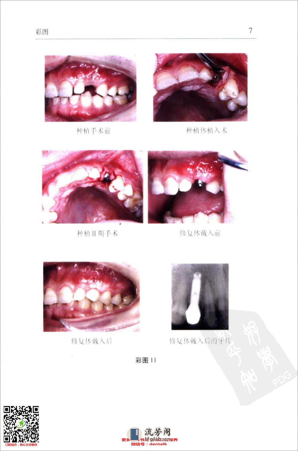 实用口腔颌面美容_11576035 - 第16页预览图