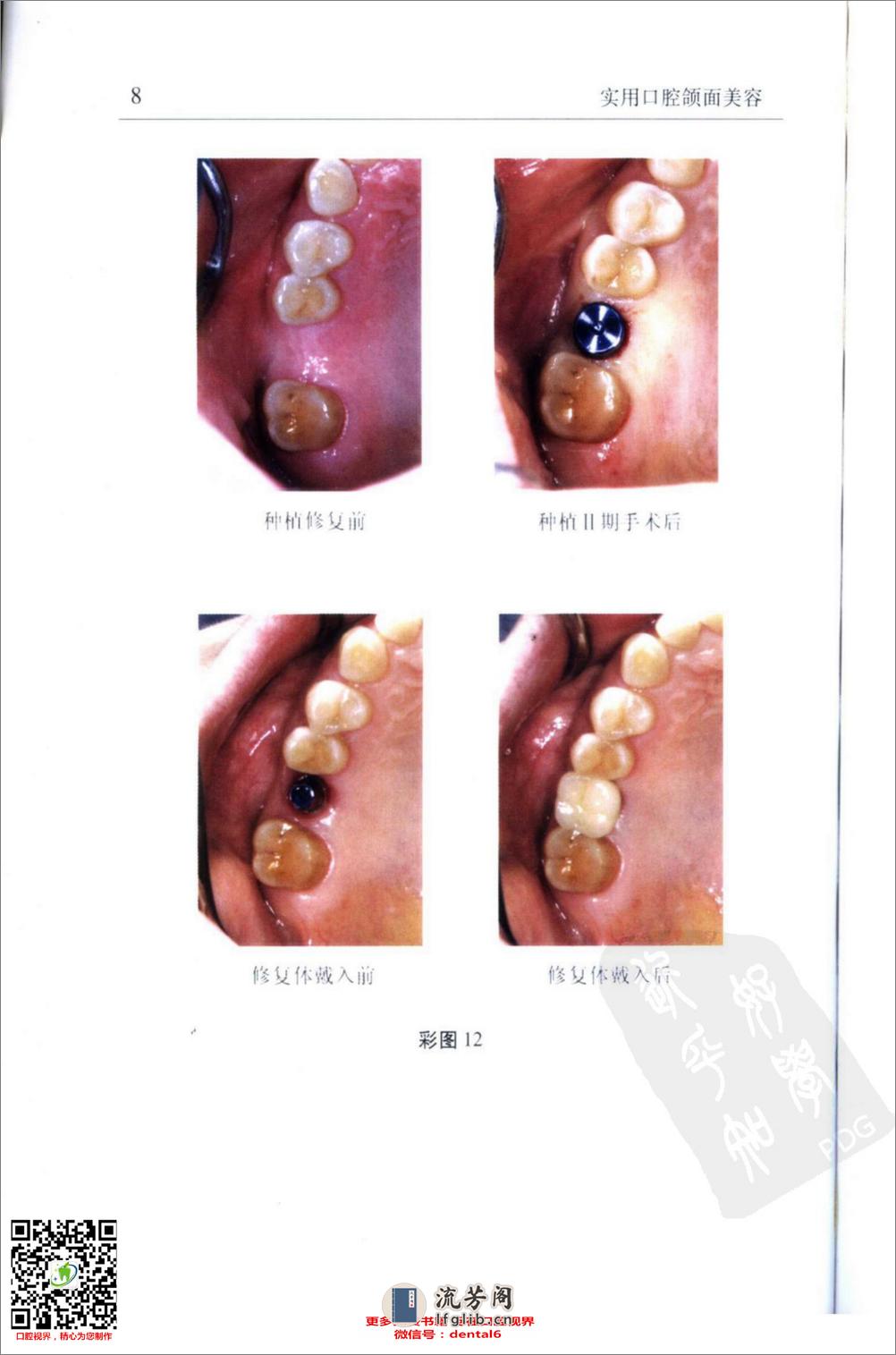 实用口腔颌面美容_11576035 - 第17页预览图