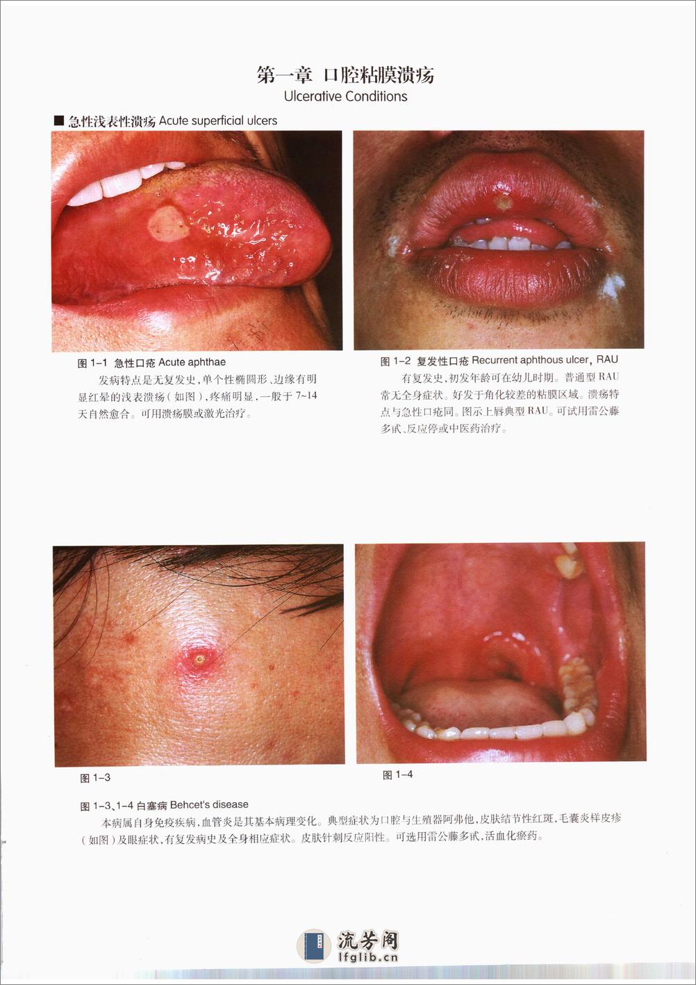 口腔粘膜病诊断学彩色图谱 - 第12页预览图