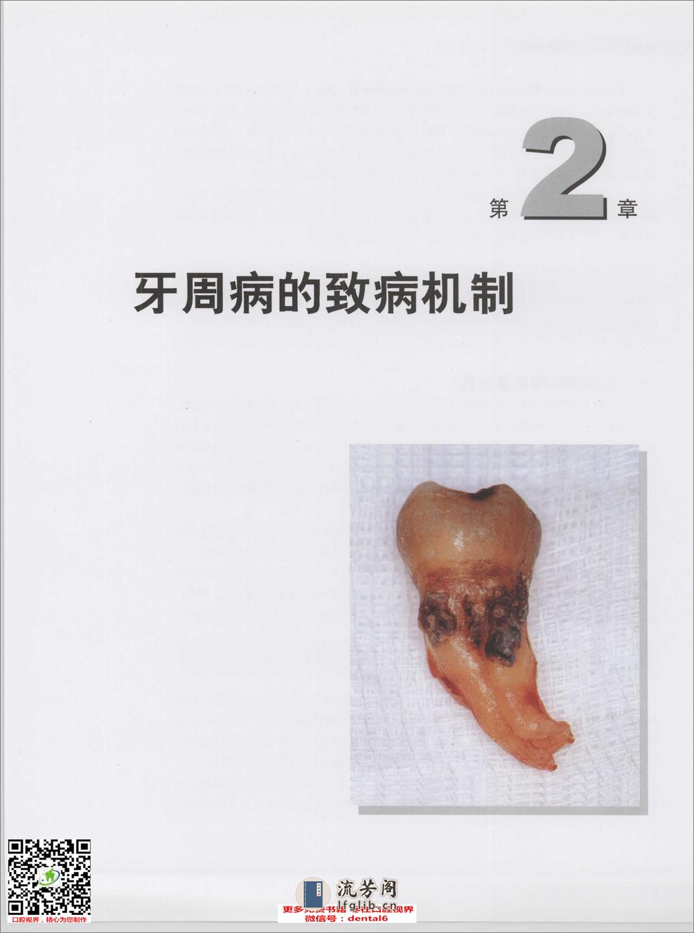 重度牙周炎治疗临床指南 - 第18页预览图