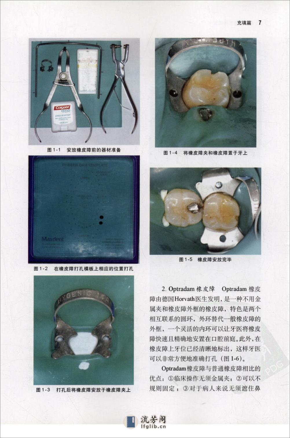 树脂修复经典案例_樊明文2009 - 第19页预览图