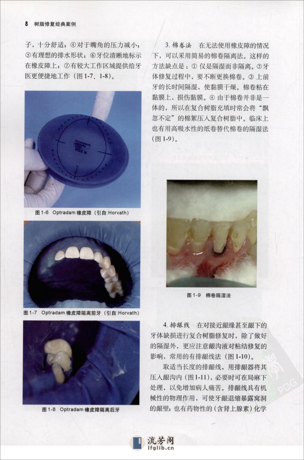 树脂修复经典案例_樊明文2009 - 第20页预览图