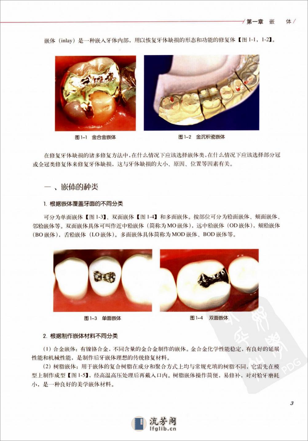 口腔固定修复的临床设计 - 第10页预览图