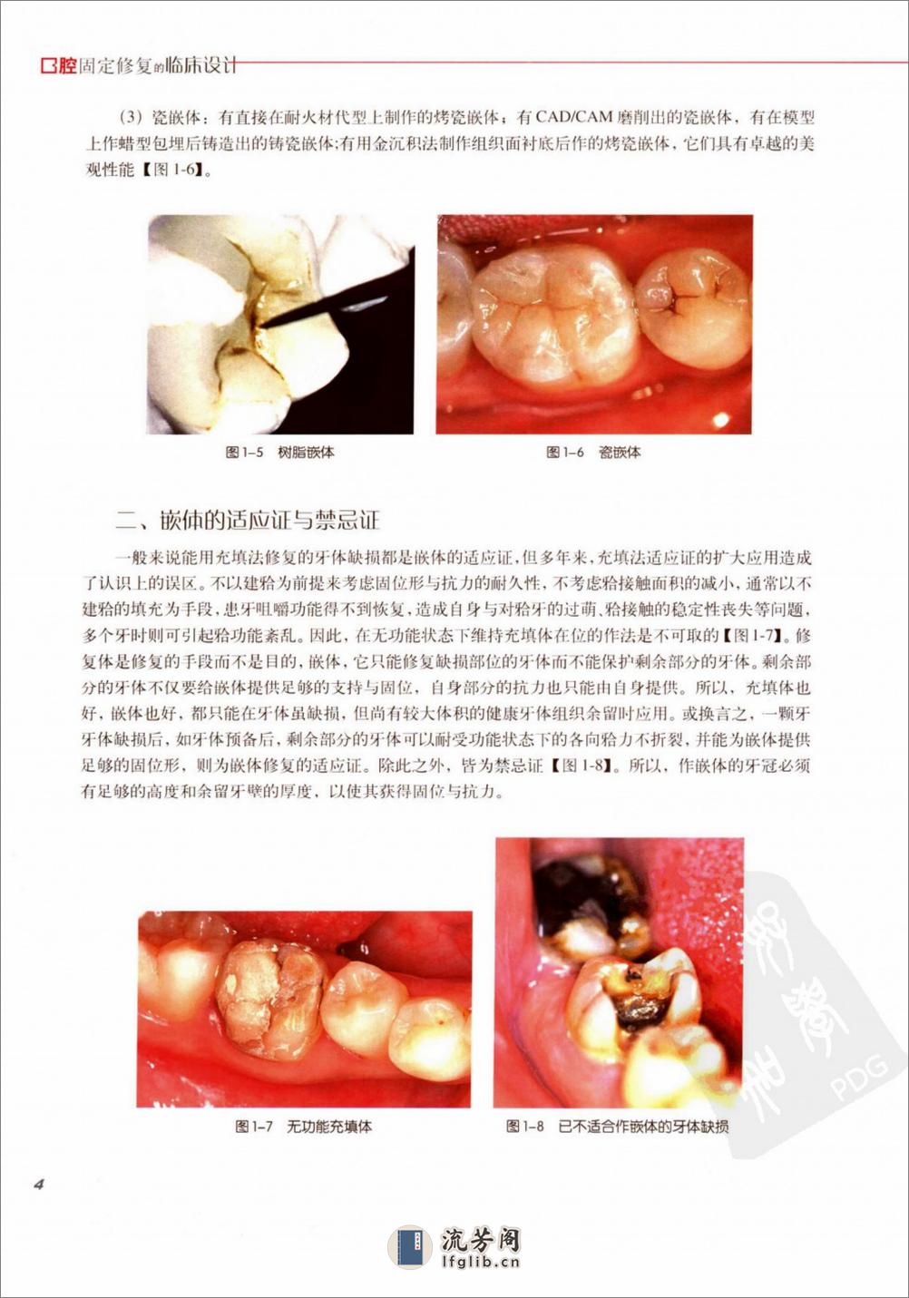 口腔固定修复的临床设计 - 第11页预览图