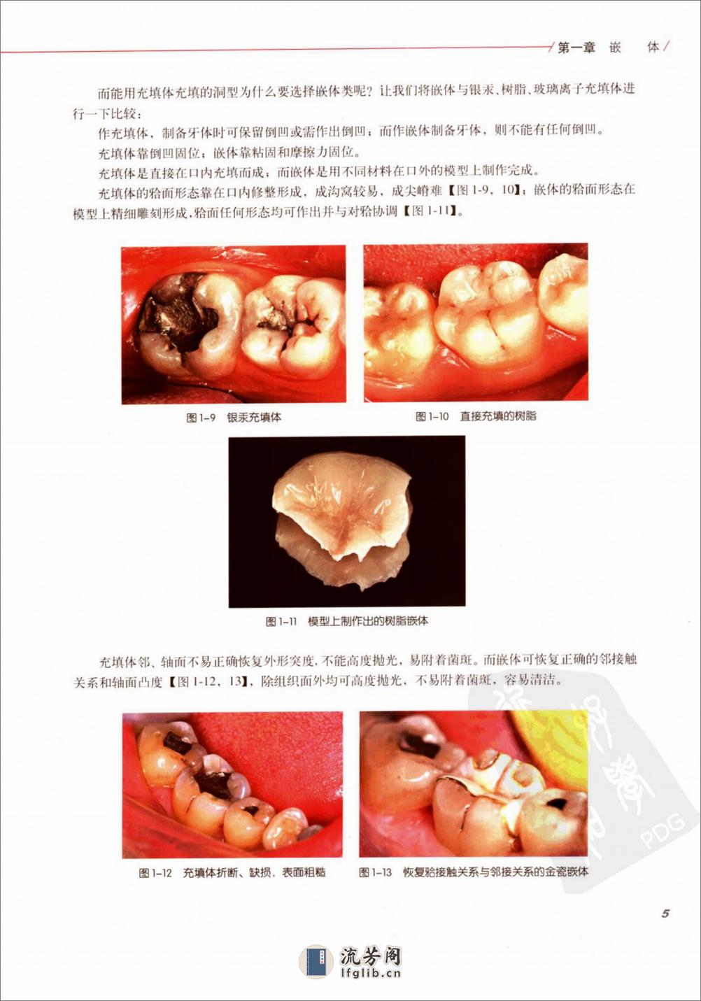 口腔固定修复的临床设计 - 第12页预览图