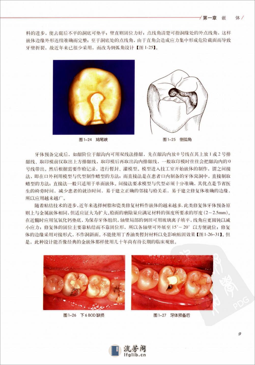 口腔固定修复的临床设计 - 第16页预览图