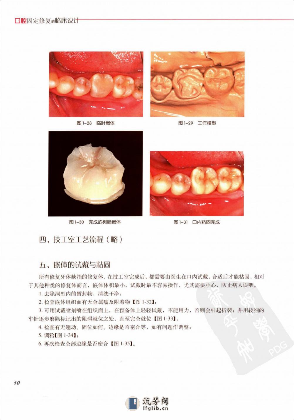 口腔固定修复的临床设计 - 第17页预览图