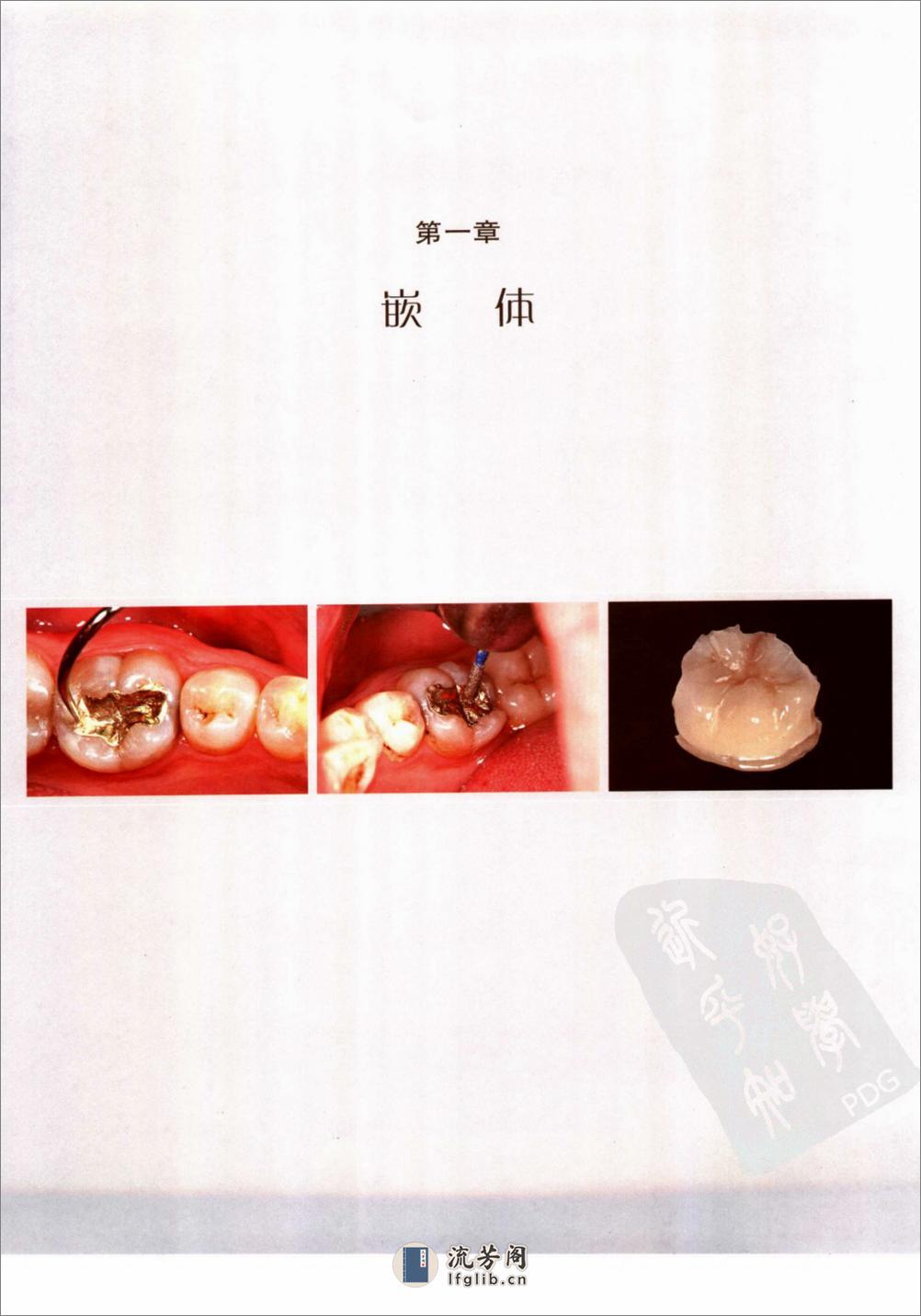 口腔固定修复的临床设计 - 第8页预览图