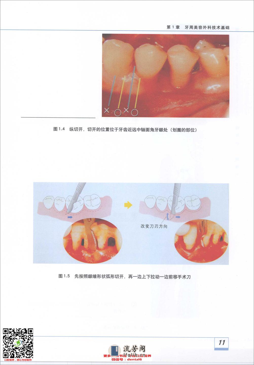 图解牙周美容外科实用技术_11929488 - 第17页预览图