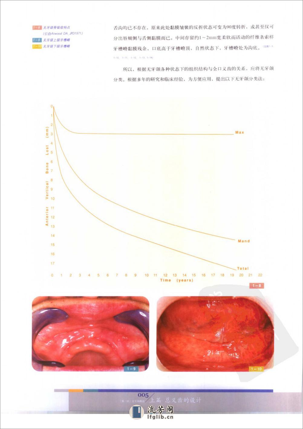 总义齿与可摘局部义齿的设计 - 第11页预览图