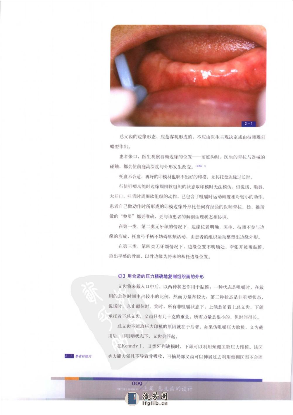 总义齿与可摘局部义齿的设计 - 第15页预览图