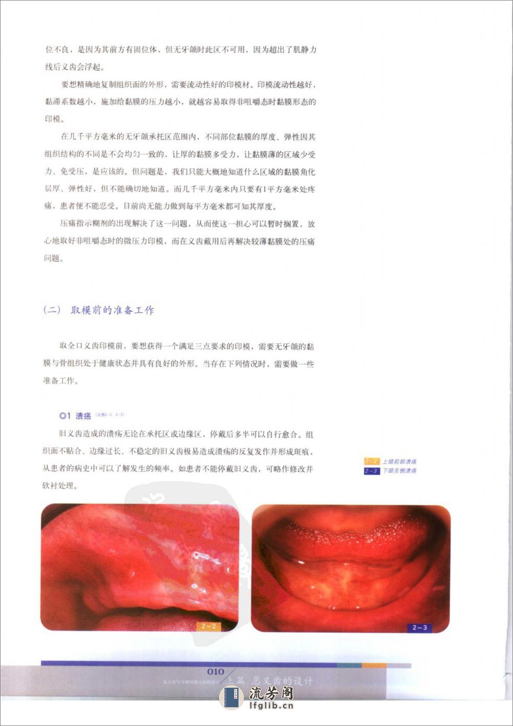 总义齿与可摘局部义齿的设计 - 第16页预览图