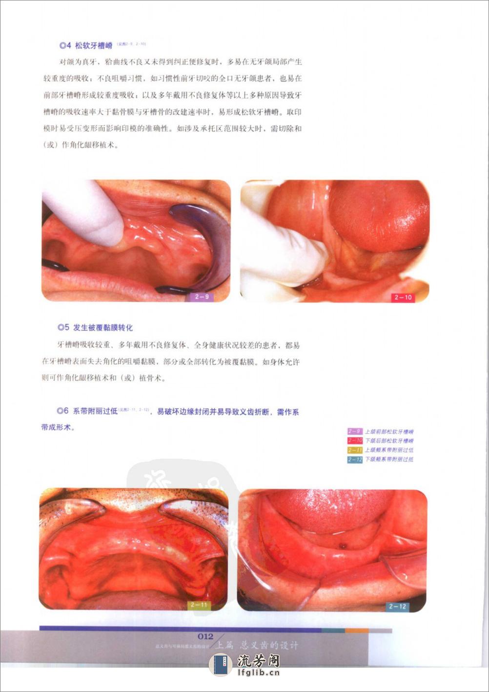 总义齿与可摘局部义齿的设计 - 第18页预览图