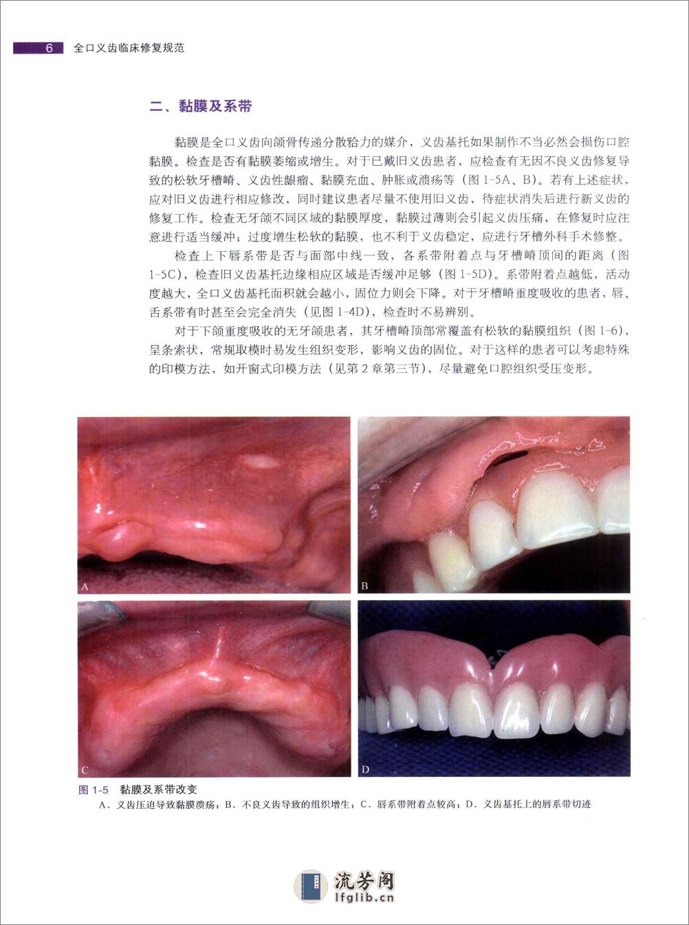 全口义齿临床修复规范 - 第17页预览图