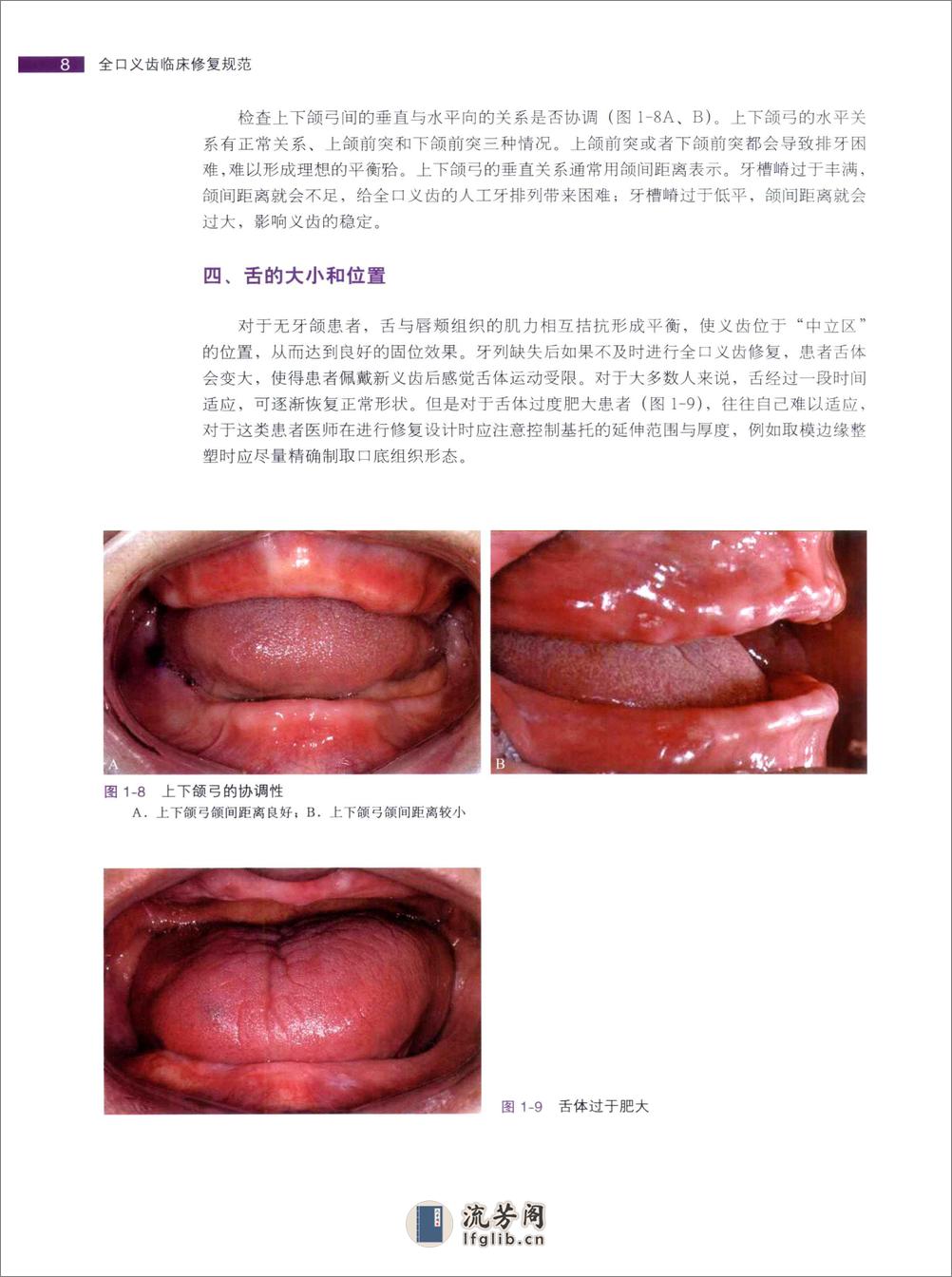 全口义齿临床修复规范 - 第19页预览图