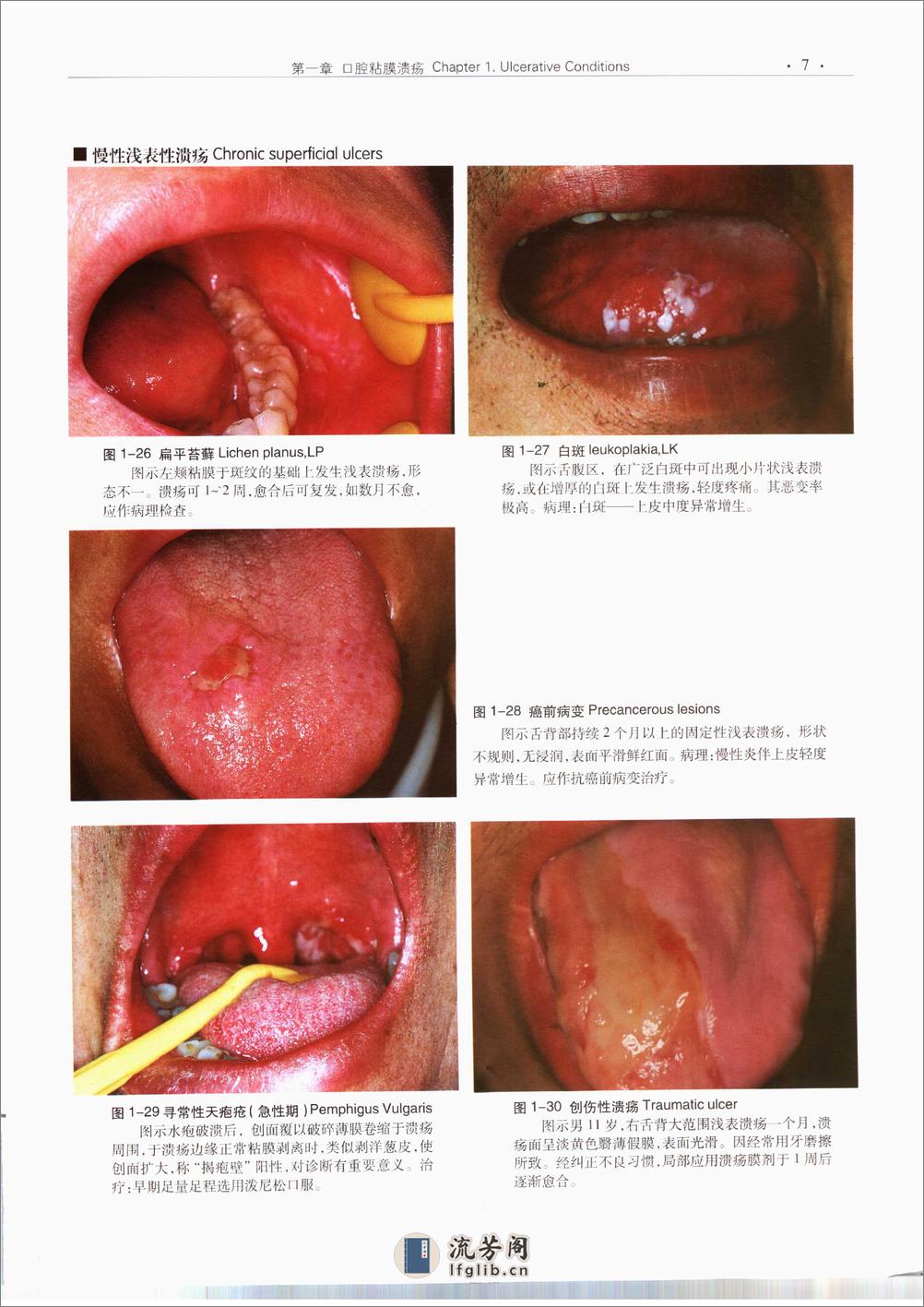 口腔粘膜病诊断学彩色图谱 - 第18页预览图