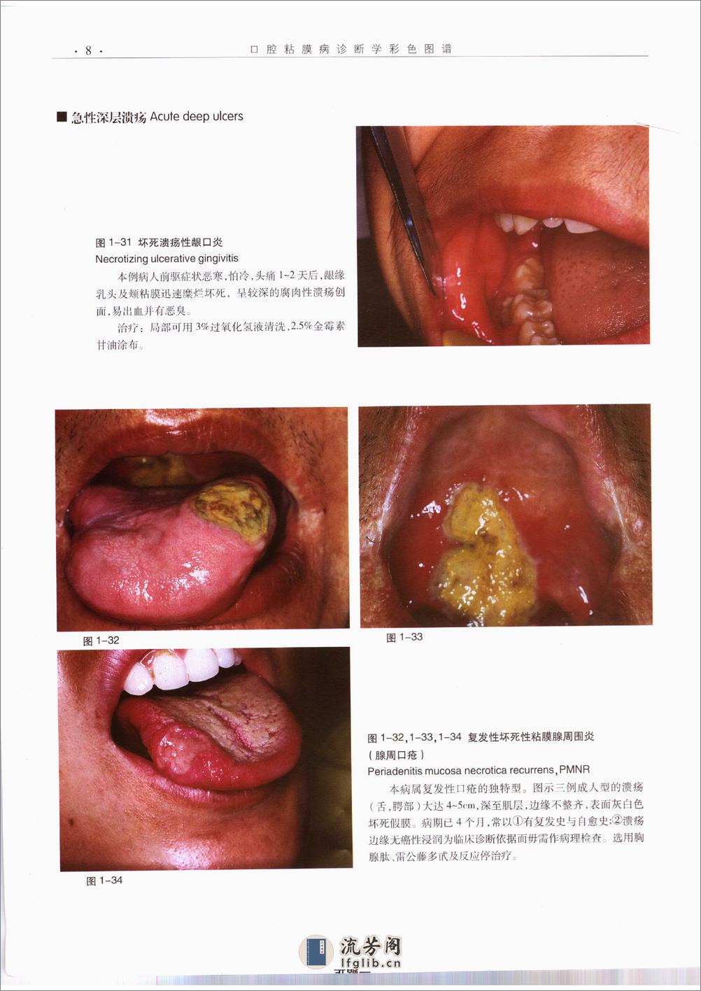 口腔粘膜病诊断学彩色图谱 - 第19页预览图