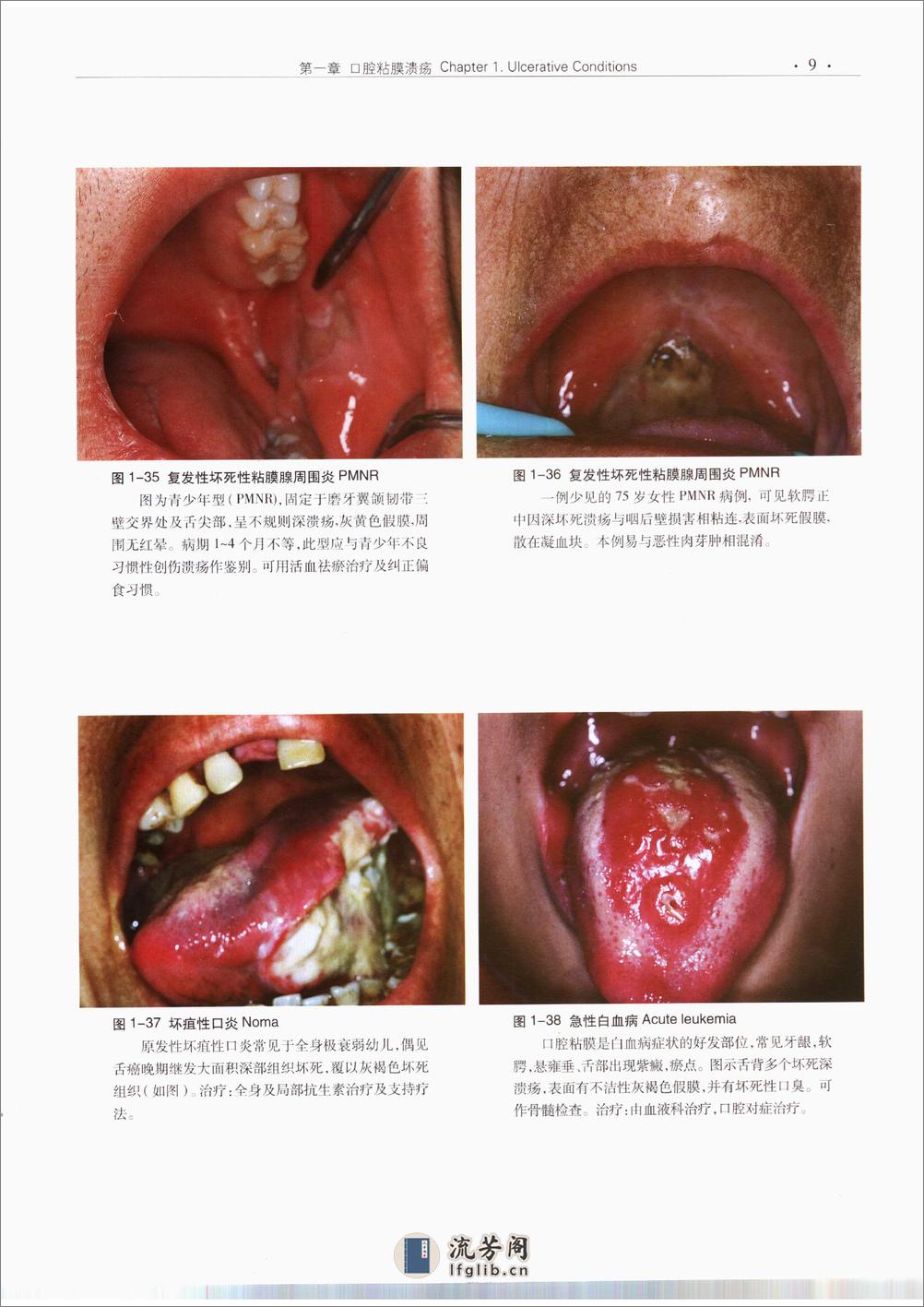 口腔粘膜病诊断学彩色图谱 - 第20页预览图