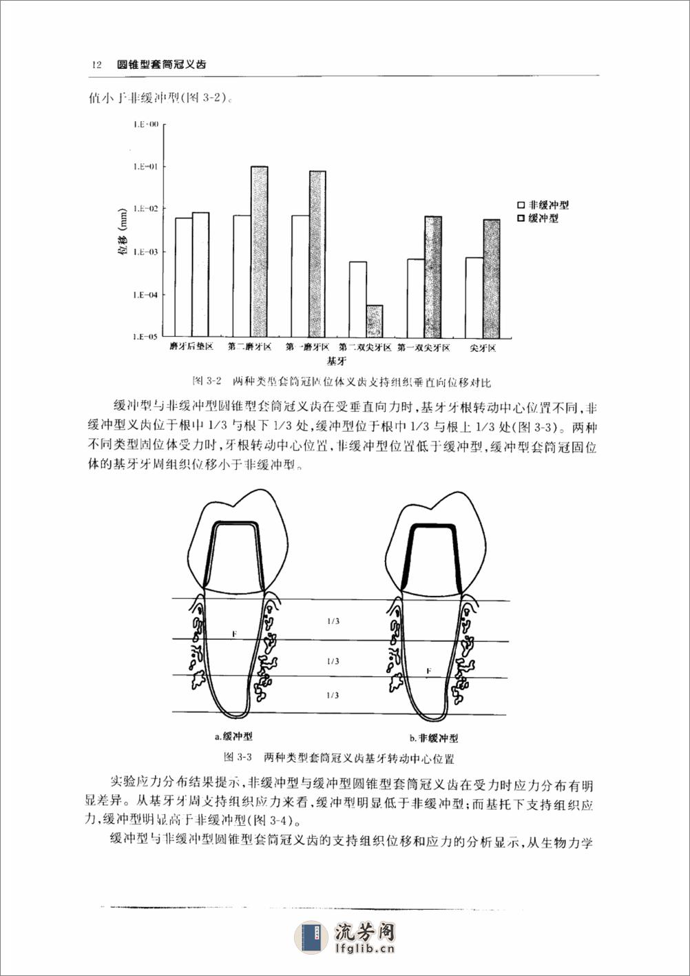 圆锥型套筒冠义齿 (pnw彩)_10855179 - 第19页预览图