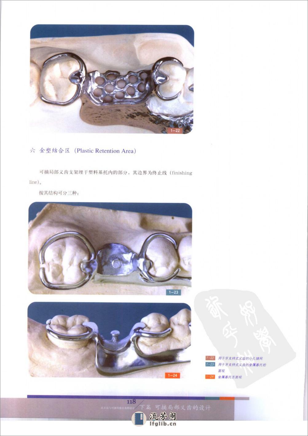 总义齿与可摘局部义齿的设计++（下册） - 第11页预览图