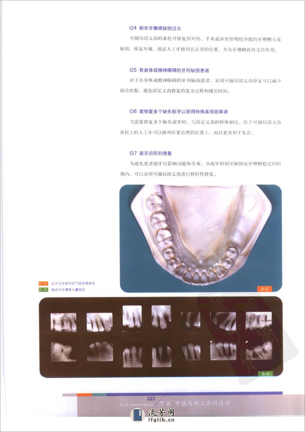 总义齿与可摘局部义齿的设计++（下册） - 第14页预览图