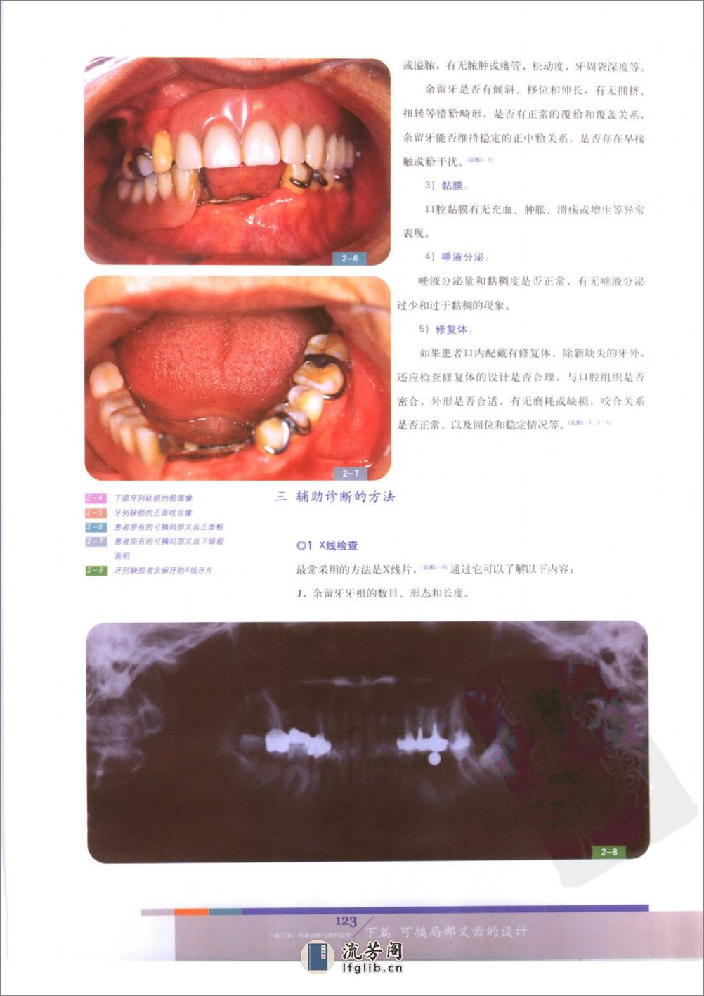 总义齿与可摘局部义齿的设计++（下册） - 第16页预览图