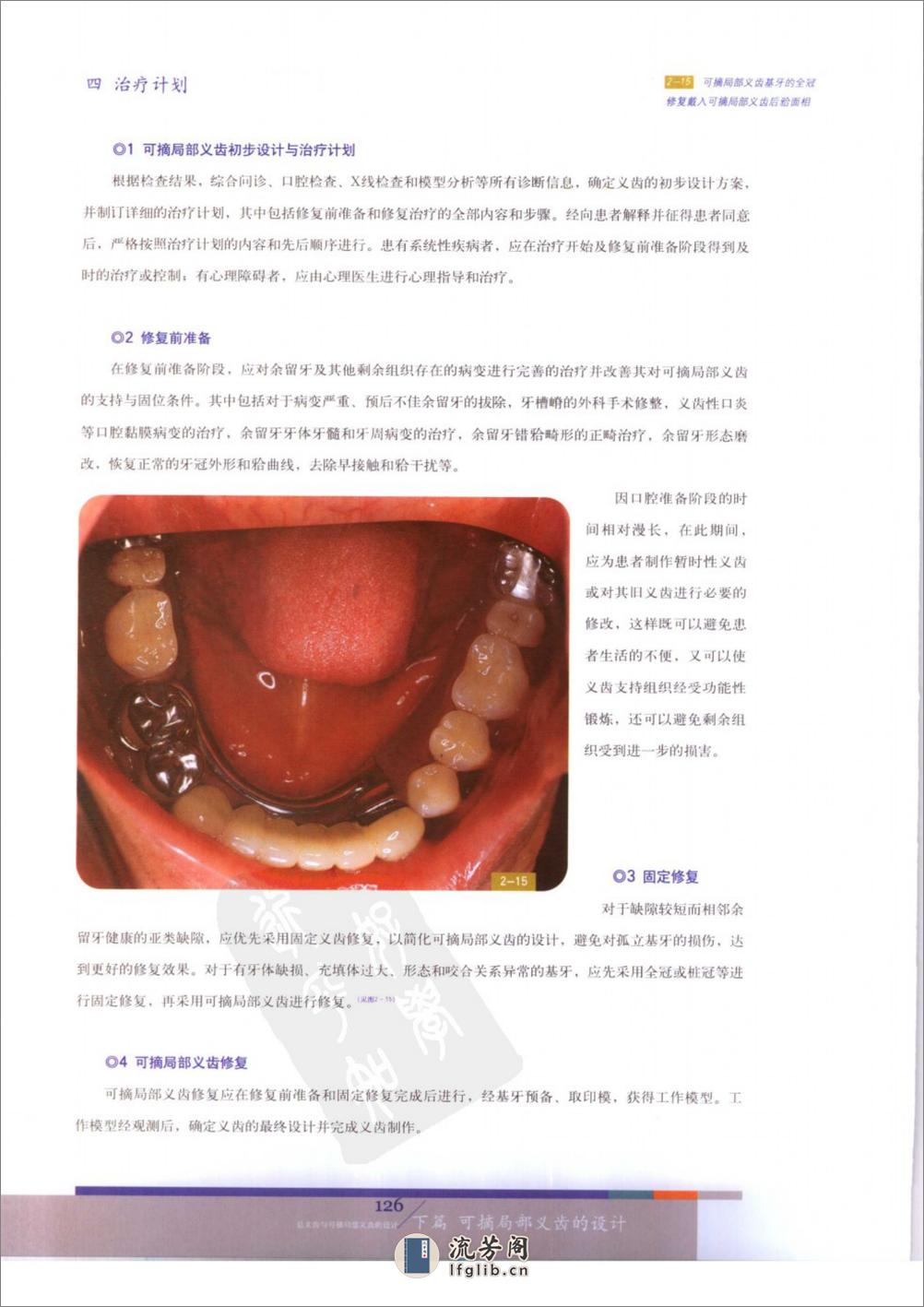 总义齿与可摘局部义齿的设计++（下册） - 第19页预览图