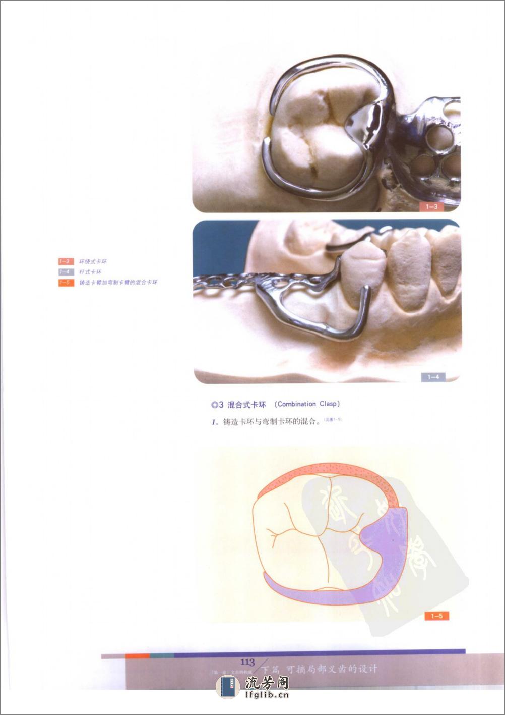 总义齿与可摘局部义齿的设计++（下册） - 第6页预览图