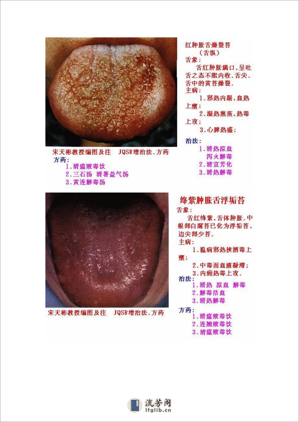 舌象图解及疗法 - 第11页预览图