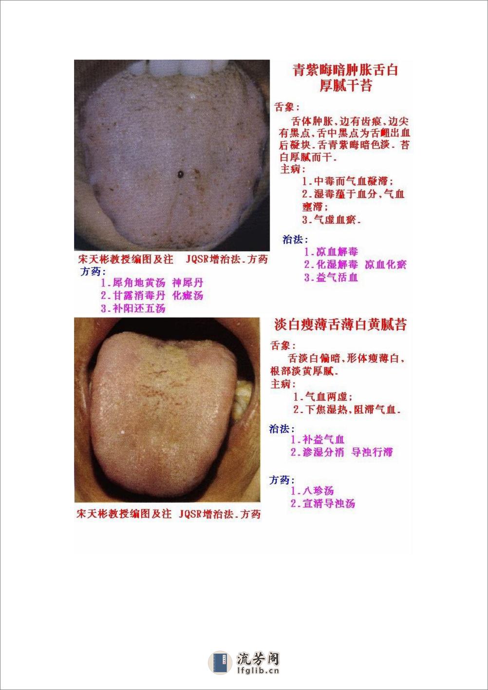 舌象图解及疗法 - 第12页预览图