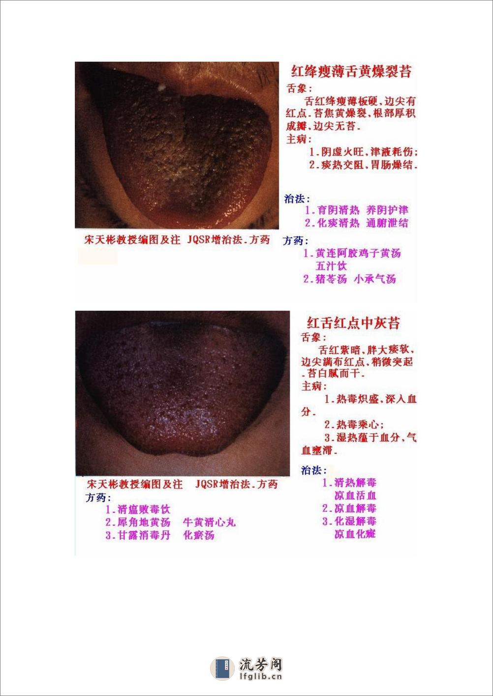 舌象图解及疗法 - 第13页预览图