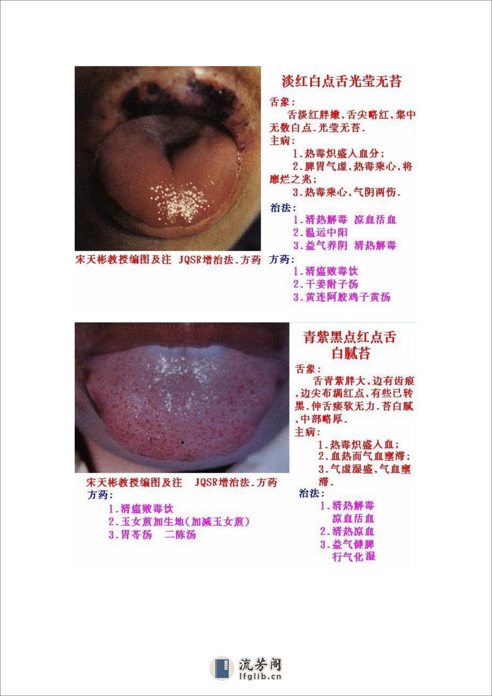 舌象图解及疗法 - 第14页预览图