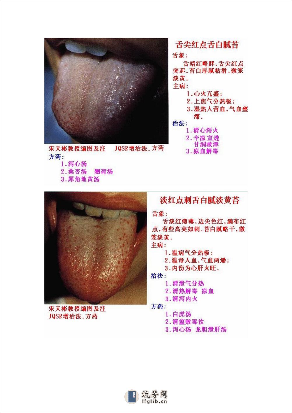 舌象图解及疗法 - 第15页预览图