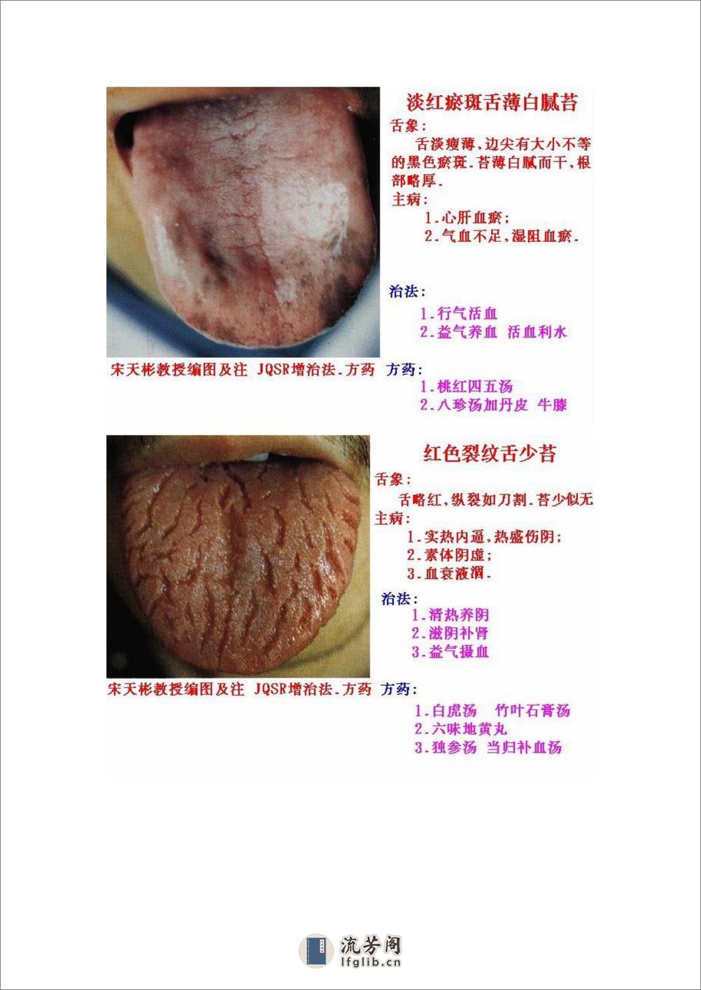 舌象图解及疗法 - 第17页预览图