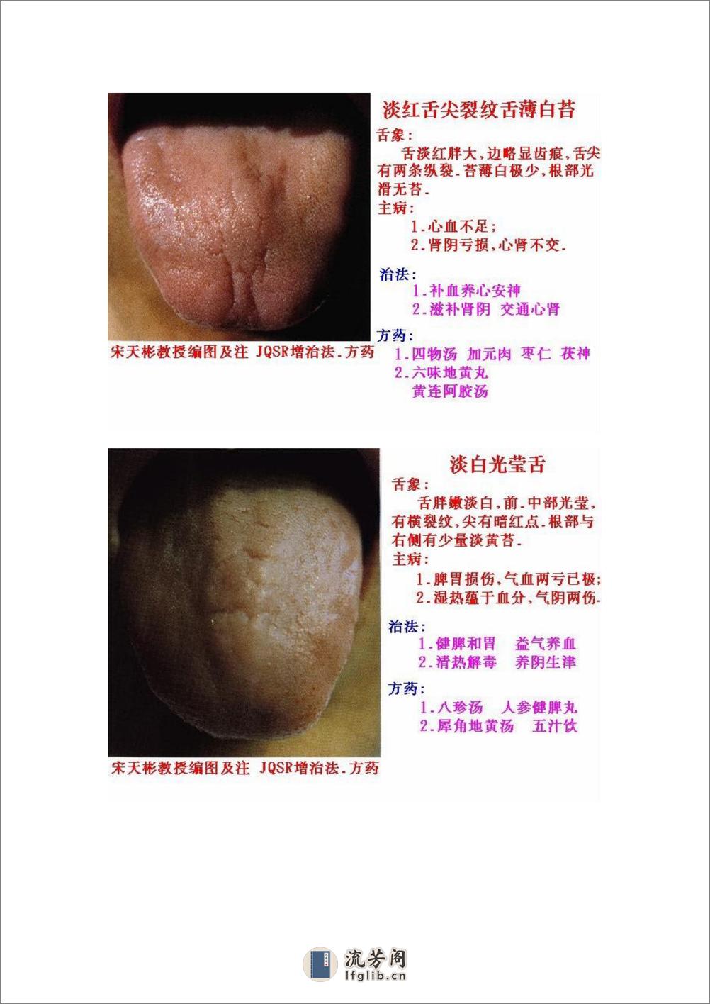 舌象图解及疗法 - 第19页预览图