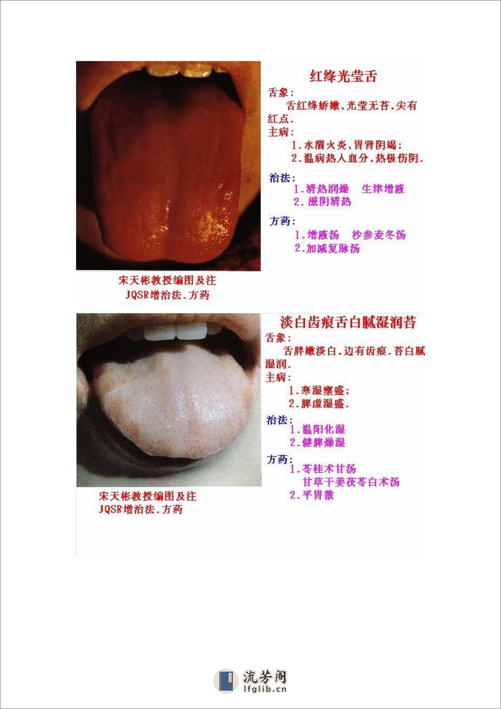 舌象图解及疗法 - 第20页预览图