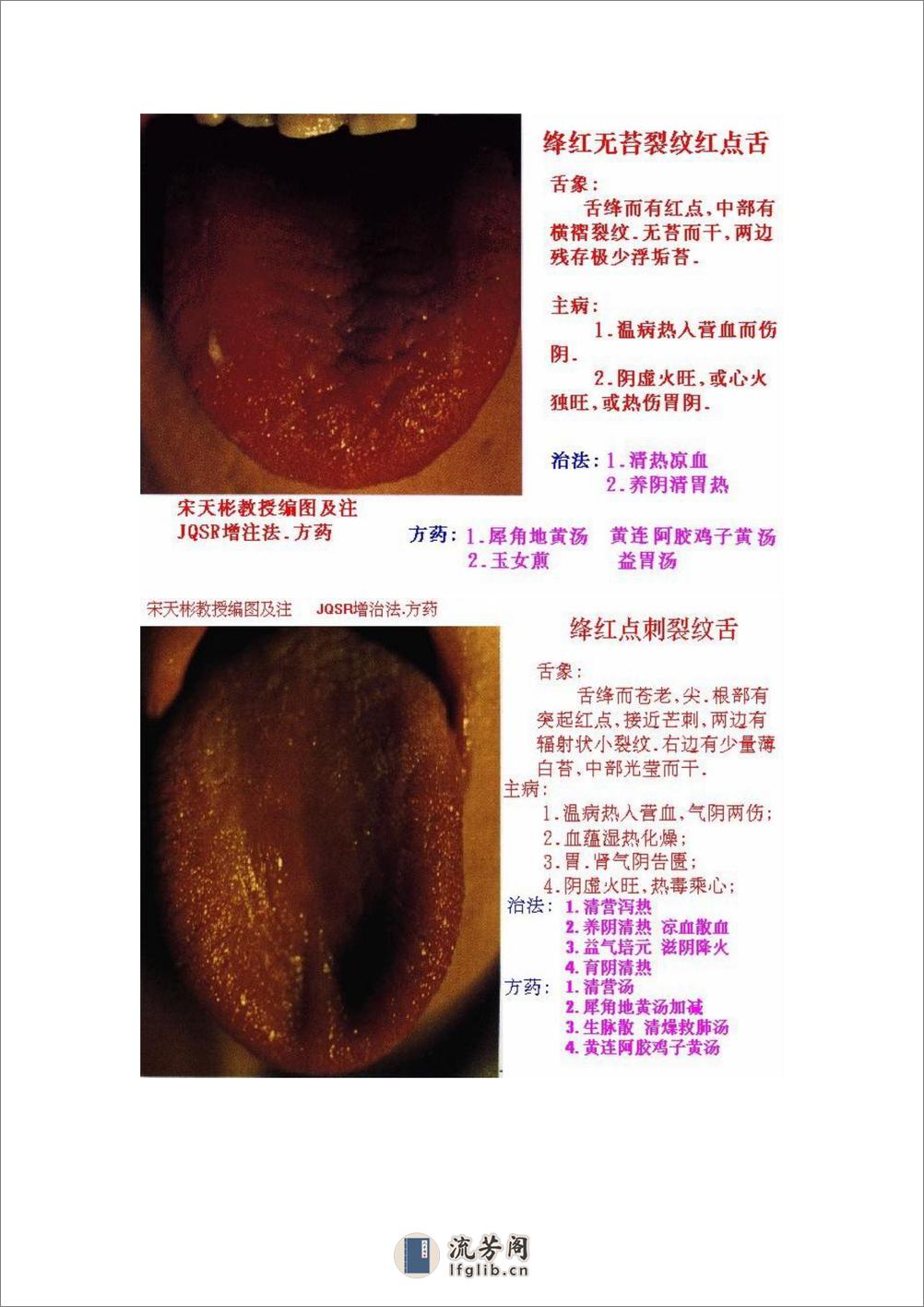 舌象图解及疗法 - 第6页预览图