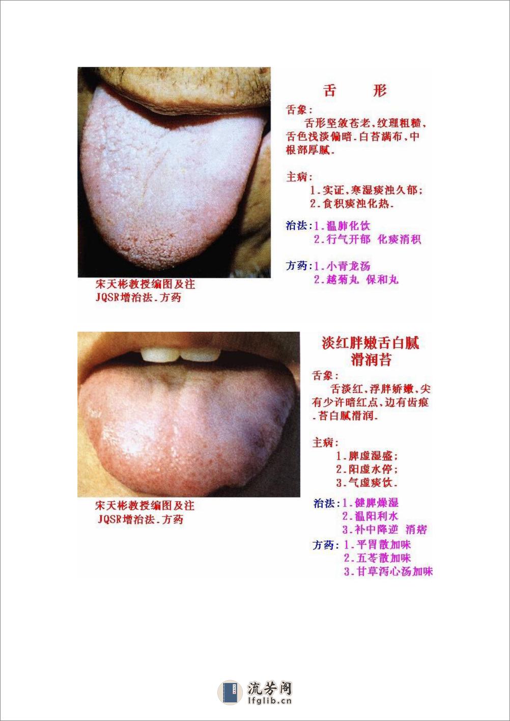 舌象图解及疗法 - 第9页预览图