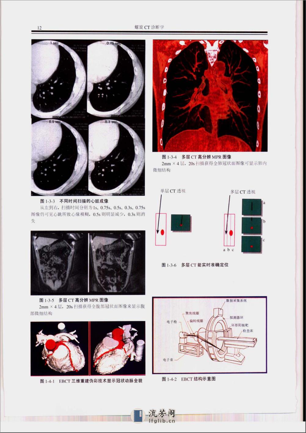 螺旋CT诊断学-清晰 - 第17页预览图