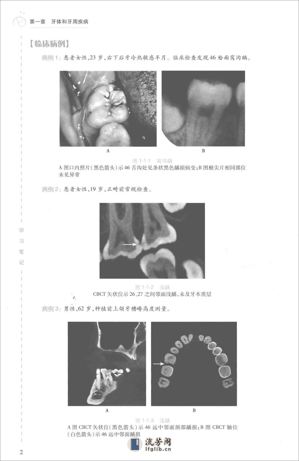 口腔医学 口腔颌面影像科分册 - 第20页预览图