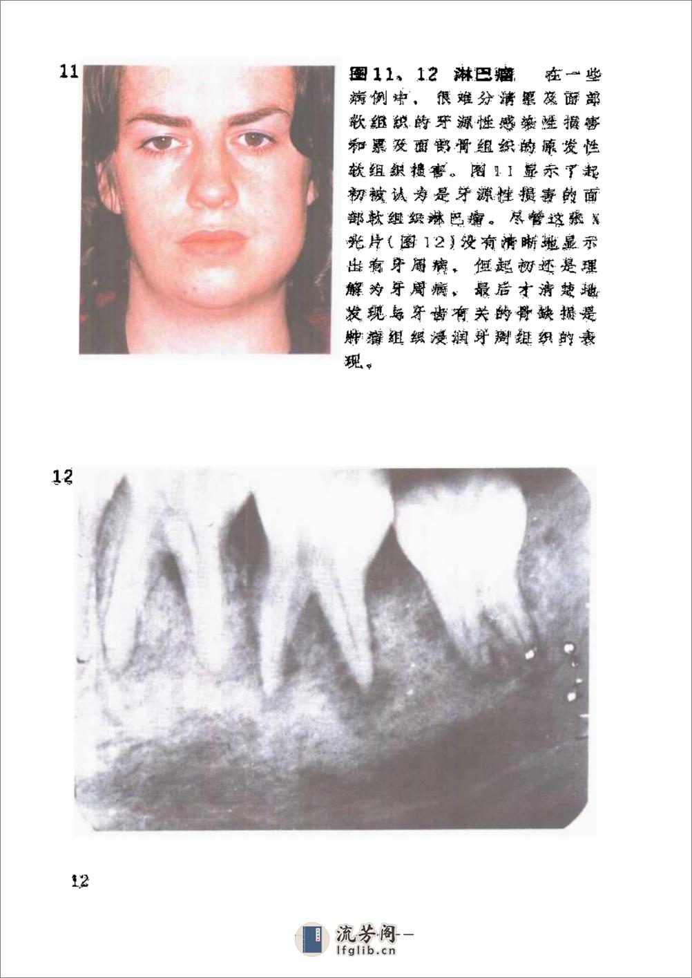 口腔颌面部疾病诊断彩色图谱 - 第15页预览图
