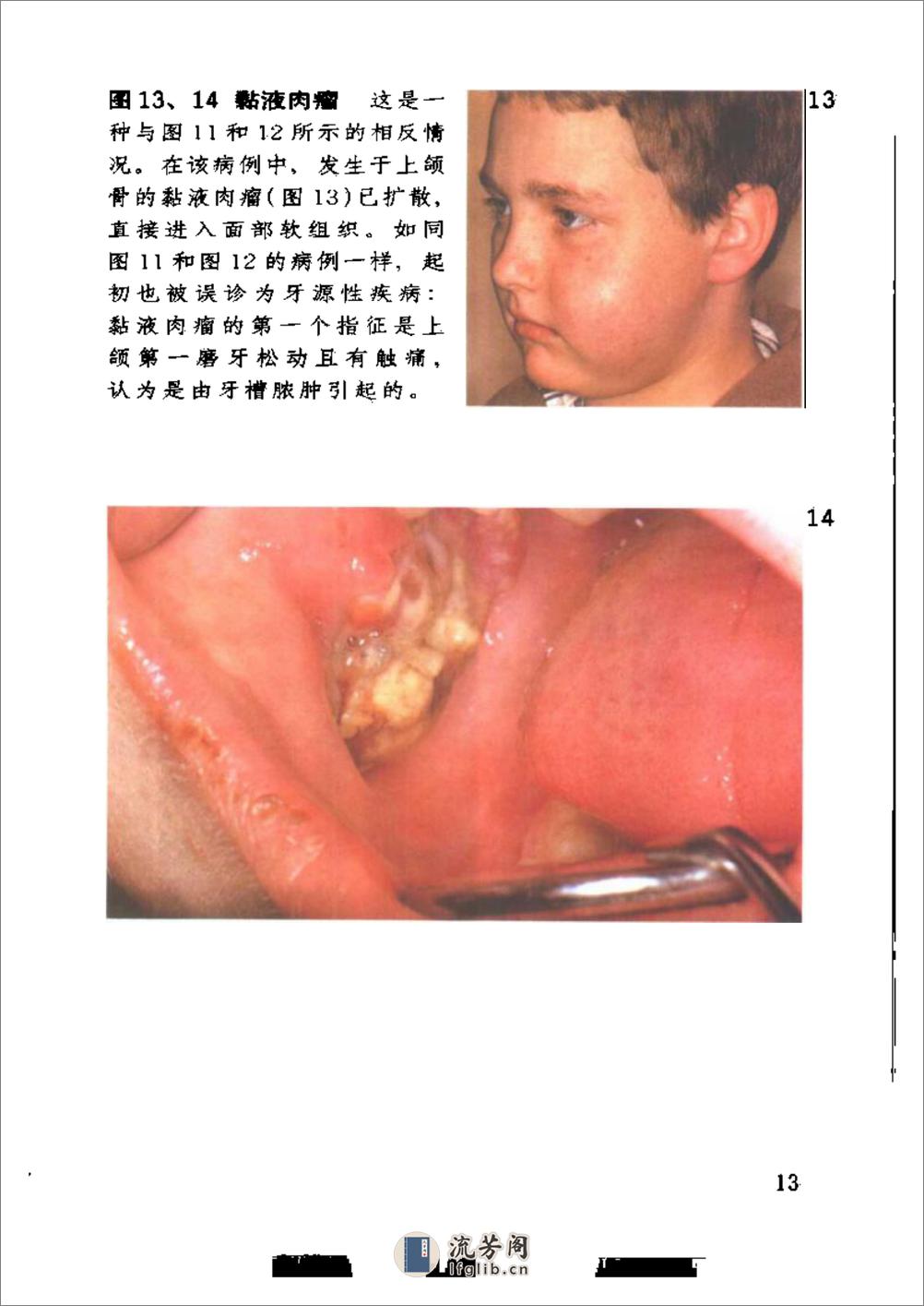口腔颌面部疾病诊断彩色图谱 - 第16页预览图